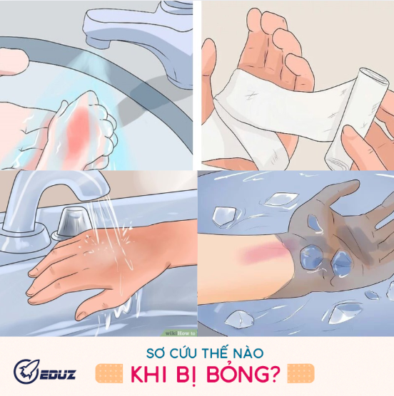 3 Phút Sơ Cứu - Bỏng